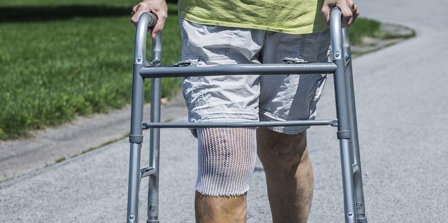 Knee Replacement Compensation Guide: Work Injuries, Car Accidents and Surgery Negligence